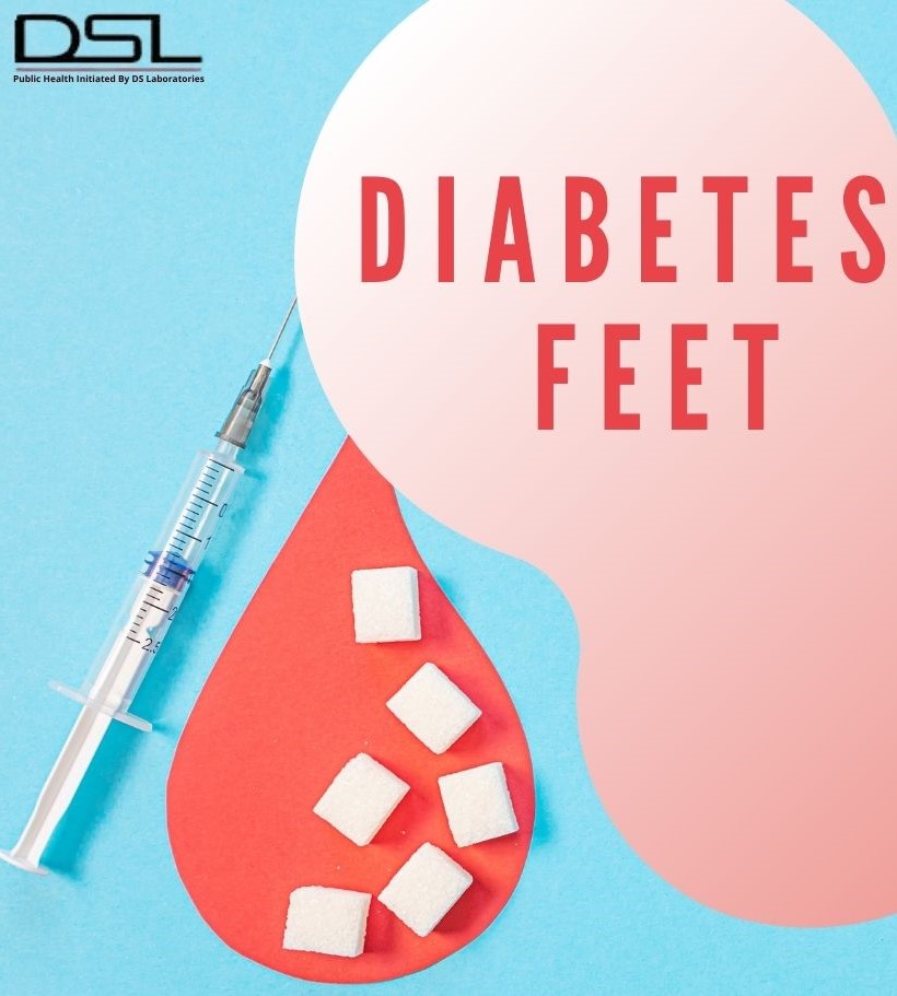 DIABETIC FEET